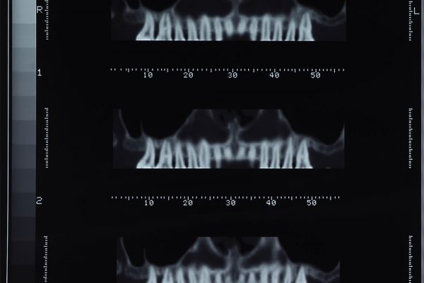 dentascan-1